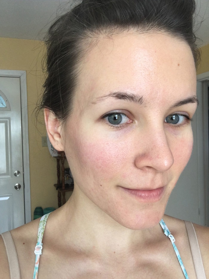 Flourish ortodoks regiment Natural Beauty: How to Apply Makeup for Acne Scars