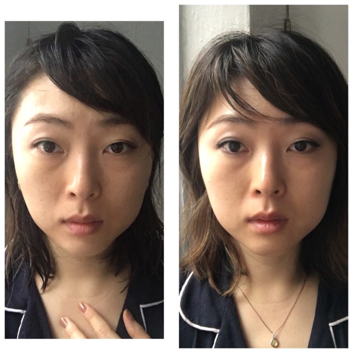 NuFACE Before and After - Review