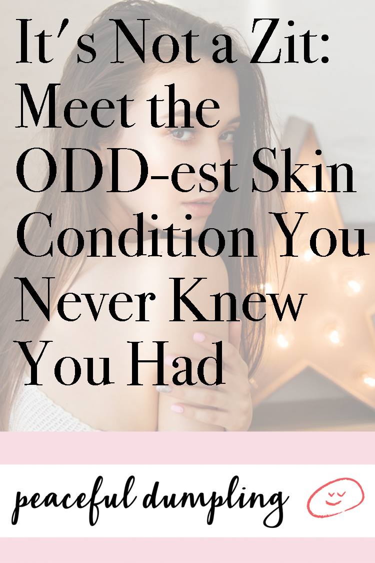 It's Not a Zit: Meet the ODD-est Skin Condition You Never Knew You Had