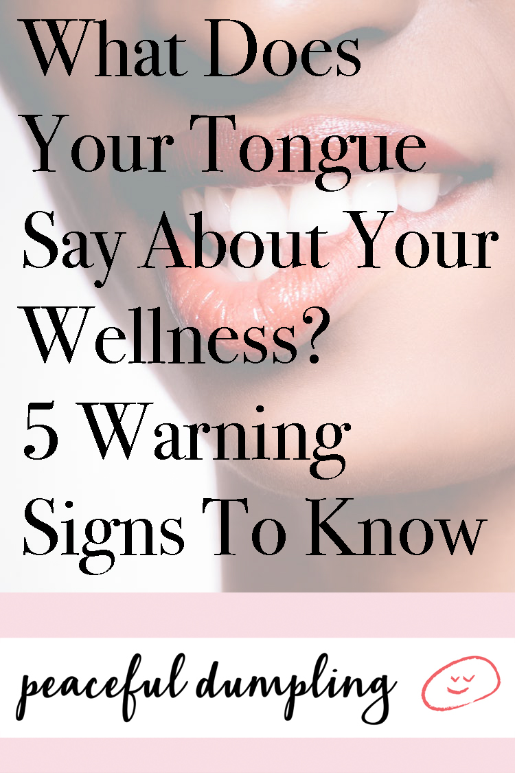 What Does Your Tongue Say About Your Wellness? 5 Warning Signs To Know