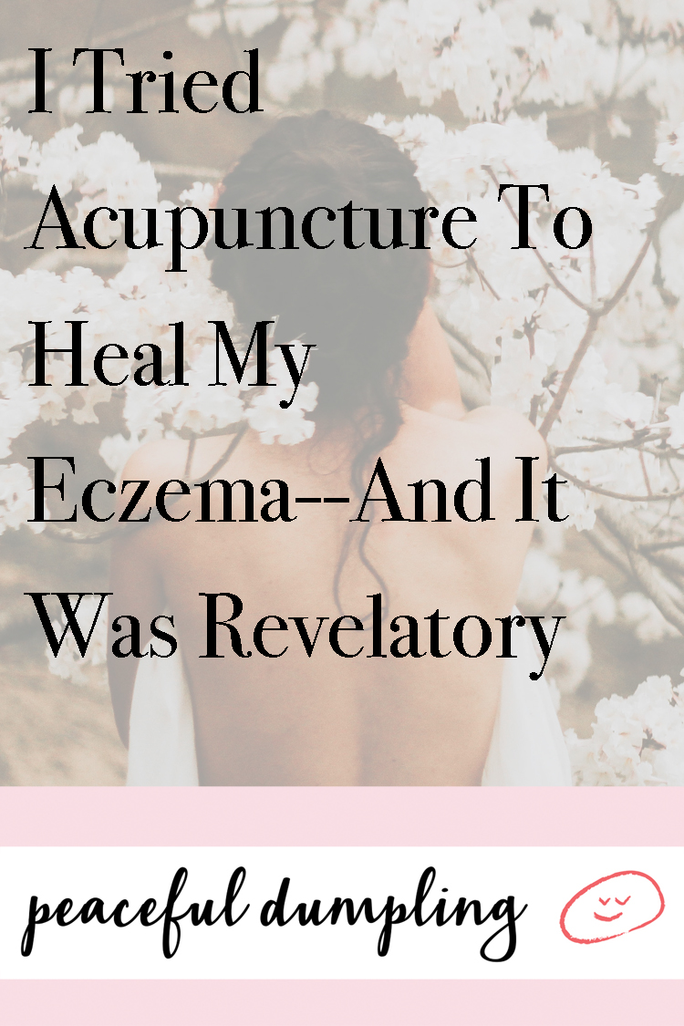 I Tried Acupuncture To Heal My Eczema--And It Was Revelatory