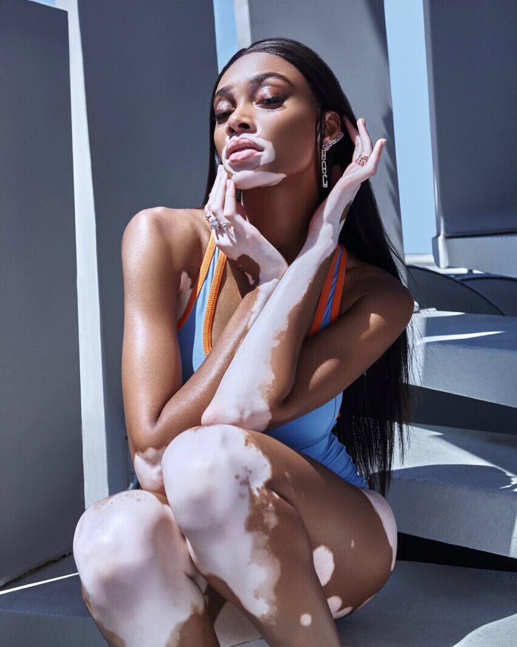 Winnie Harlow's Advice About Defining Your Beauty Will Give You All The Feels