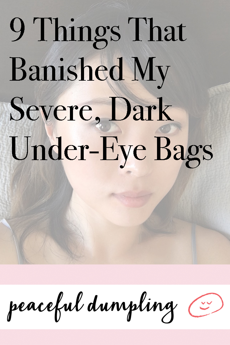 9 Things That Banished My Severe, Dark Under-Eye Bags