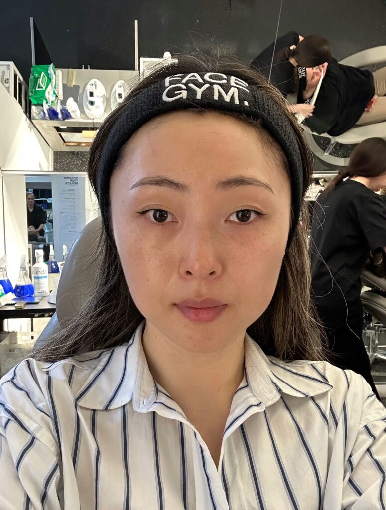 a woman wearing face gym headband before the treatment begins